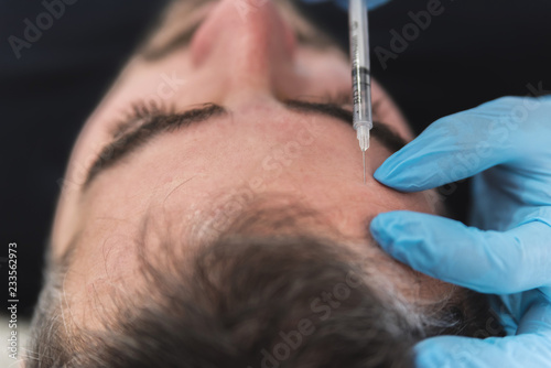 Man having forehead fillers done