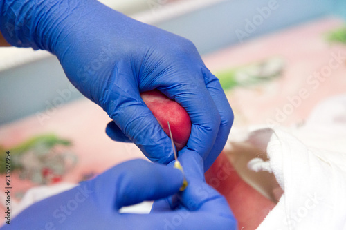 Newborn blood spot  heel prick  test  the Guthrie  test . A physician performing the pinprick puncture in one heel of a newborn to collect their blood to screen for inborn errors of metabolism. 