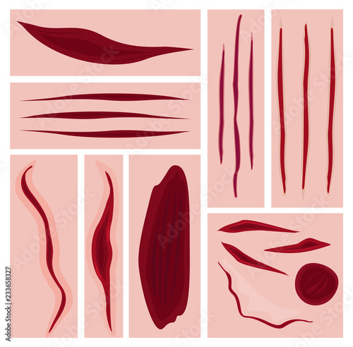 Vector illustration set of cuts, scars, bruises and slaughter. Bloody scars collection isolated on skin color background.