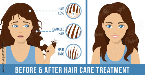Hair care. Common problems - split ends, damaged hair, hair loss. Before and after care treatment. Vector