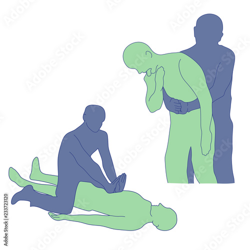 Choking first aid. Vector.