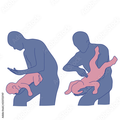 Choking first aid. Vector.