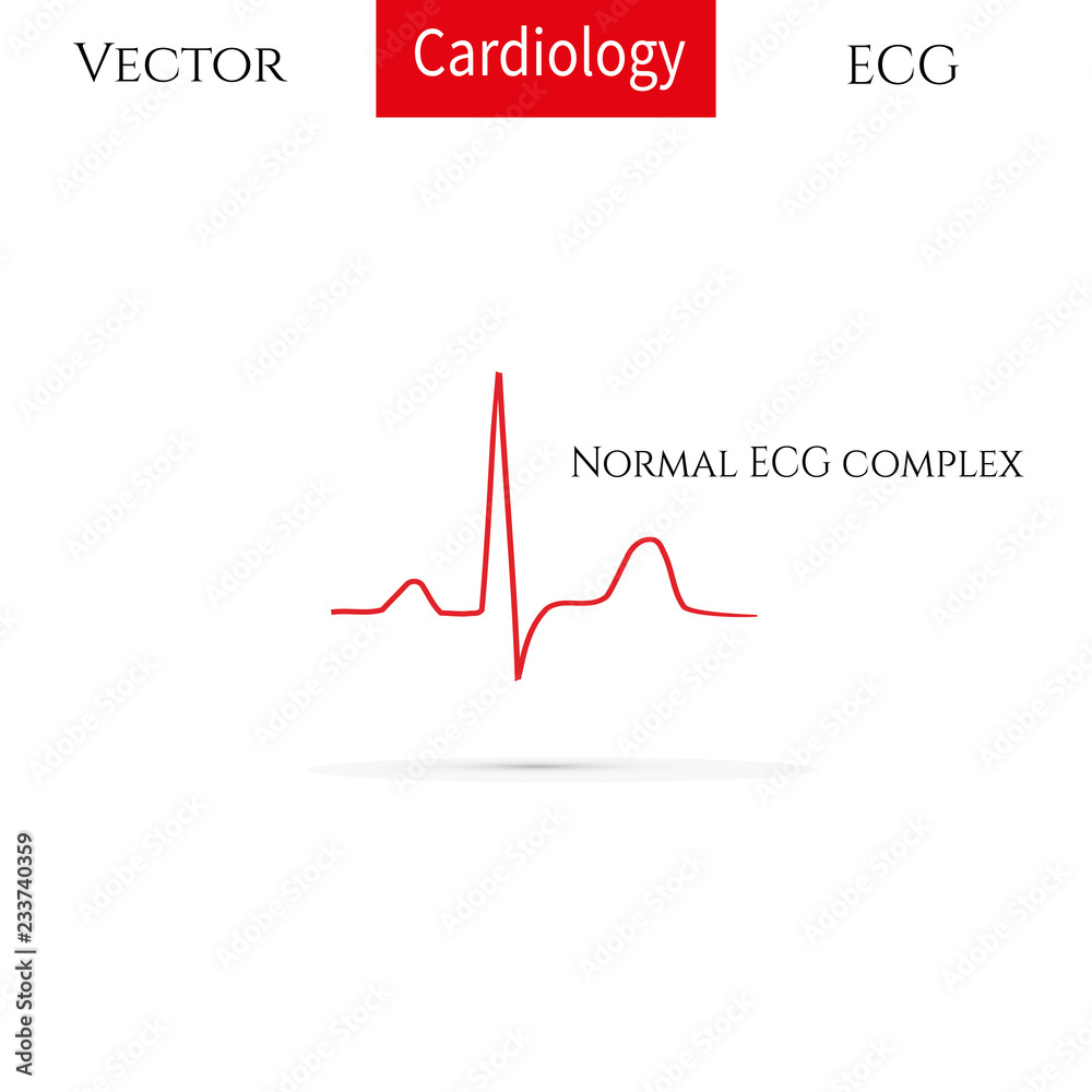 Electrocardiogram, ecg line. Normal ECG complex. Normal heart rhythm. Electrocardiogram, ecg line. Normal ECG complex. Normal heart rhythm.