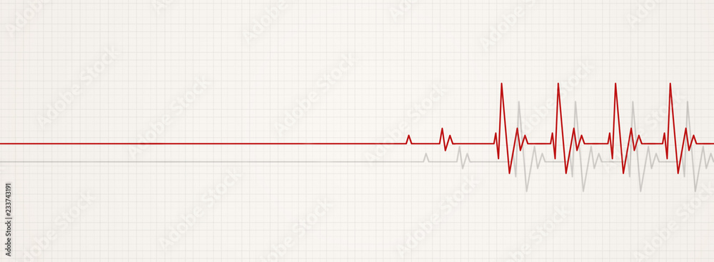 back to life ecg