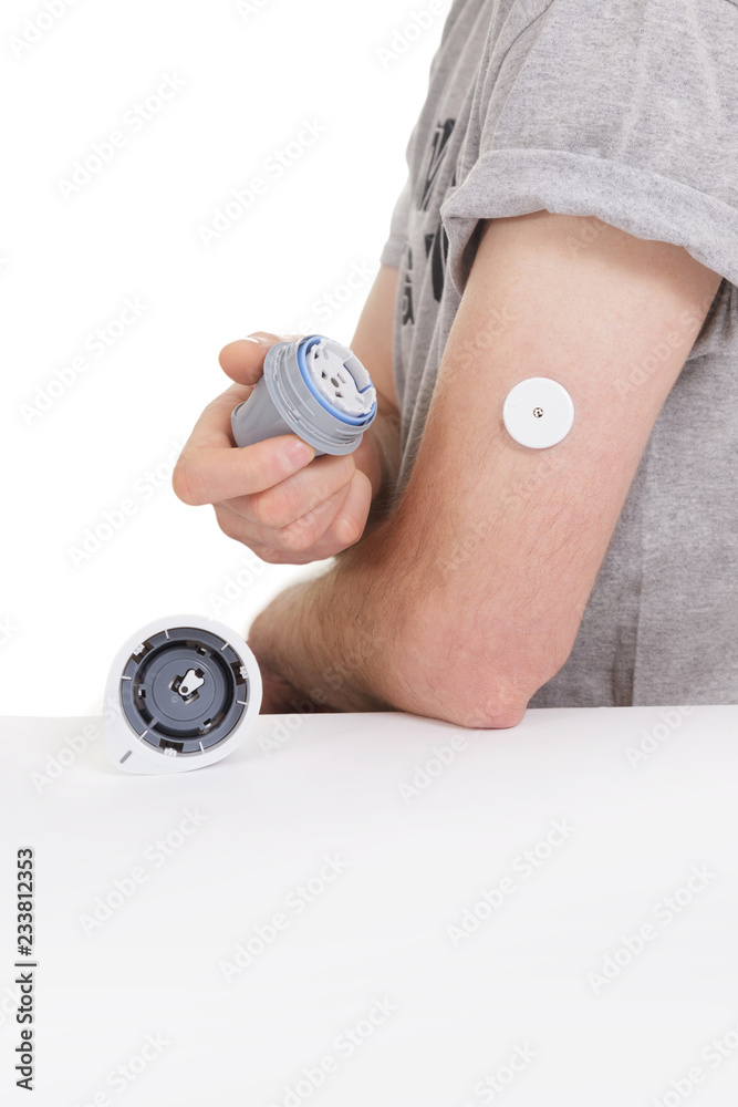 Fototapeta premium sensor diabetes checkup glucose man system sugar monitoring scan test hand skin medicine syringe table white background