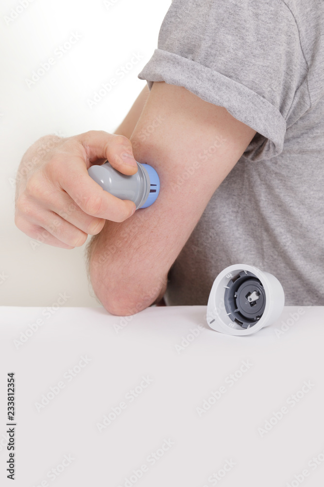 Fototapeta premium sensor diabetes checkup glucose man system sugar monitoring scan test hand skin medicine syringe table white background