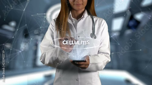 Female Doctor Hologram Word Cellulitis photo