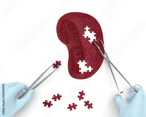 Spleen puzzle concept: hands of surgeon with surgical instruments (tools) performs spleen surgery as a result of splenomegaly, splenic infarction, megalosplenia, splenelcosis, splenitis, anemia, cysts photo