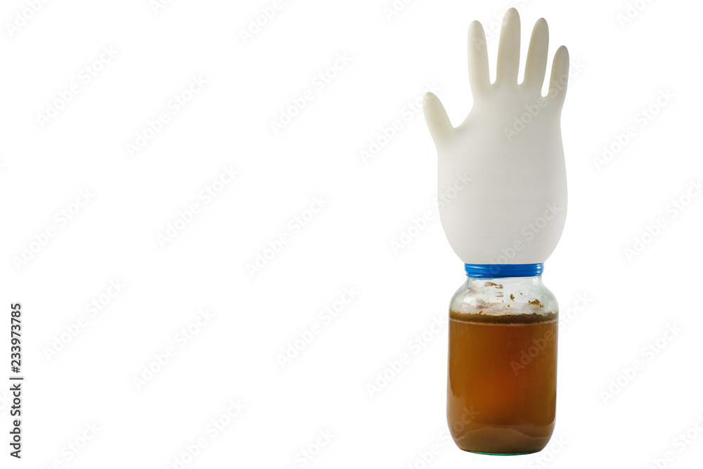 Fermented grape juice in a glass jar, covered with a medical rubber glove Fermented grape juice in a glass jar, covered with a medical rubber glove