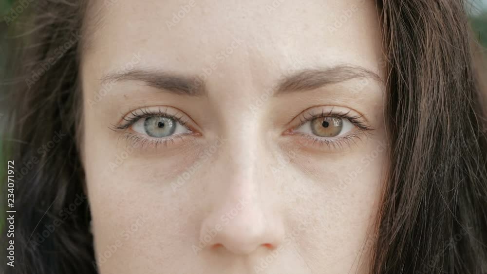 girl show different eyes looks at the camera, heterochromia girl show different eyes looks at the camera, heterochromia