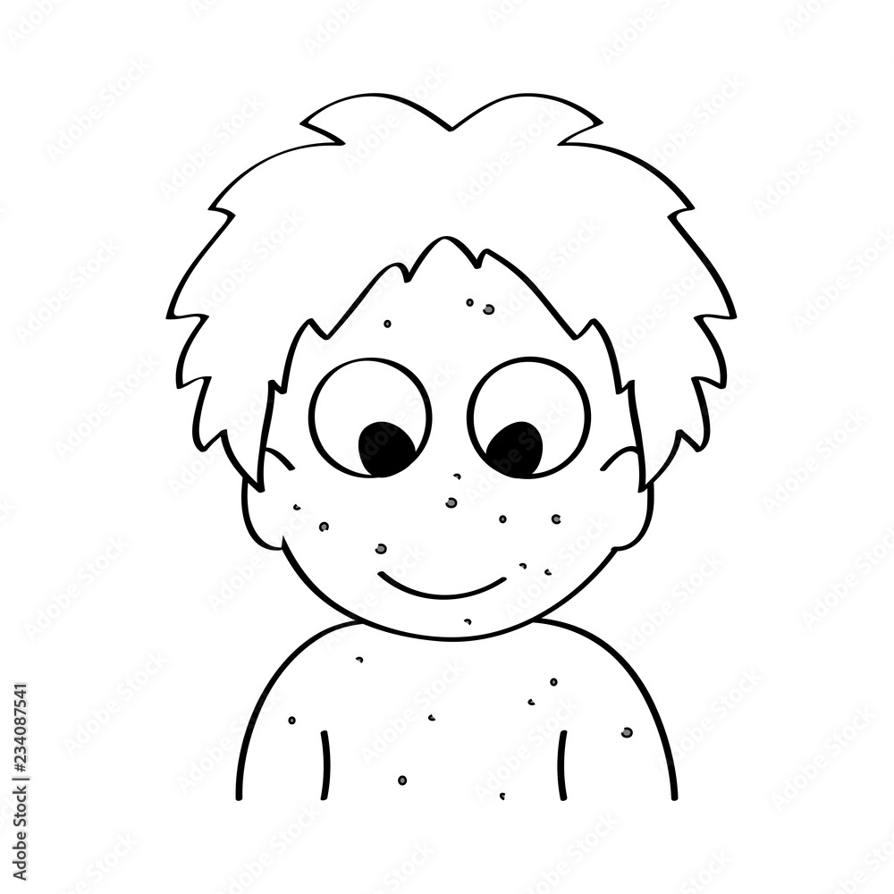 Fototapeta premium Happy sick child with skin rash, chicken pox disease. Cartoon outline vector