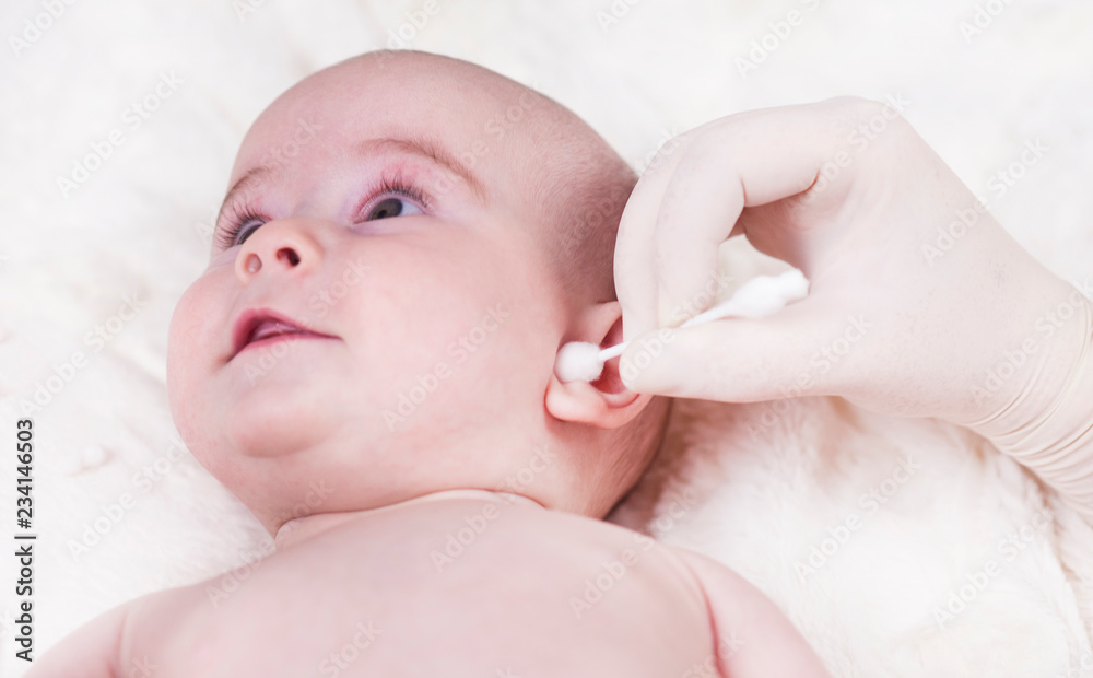 The child at the doctor's office and his ears are cleaned with a cotton swab. The child at the doctor's office and his ears are cleaned with a cotton swab.