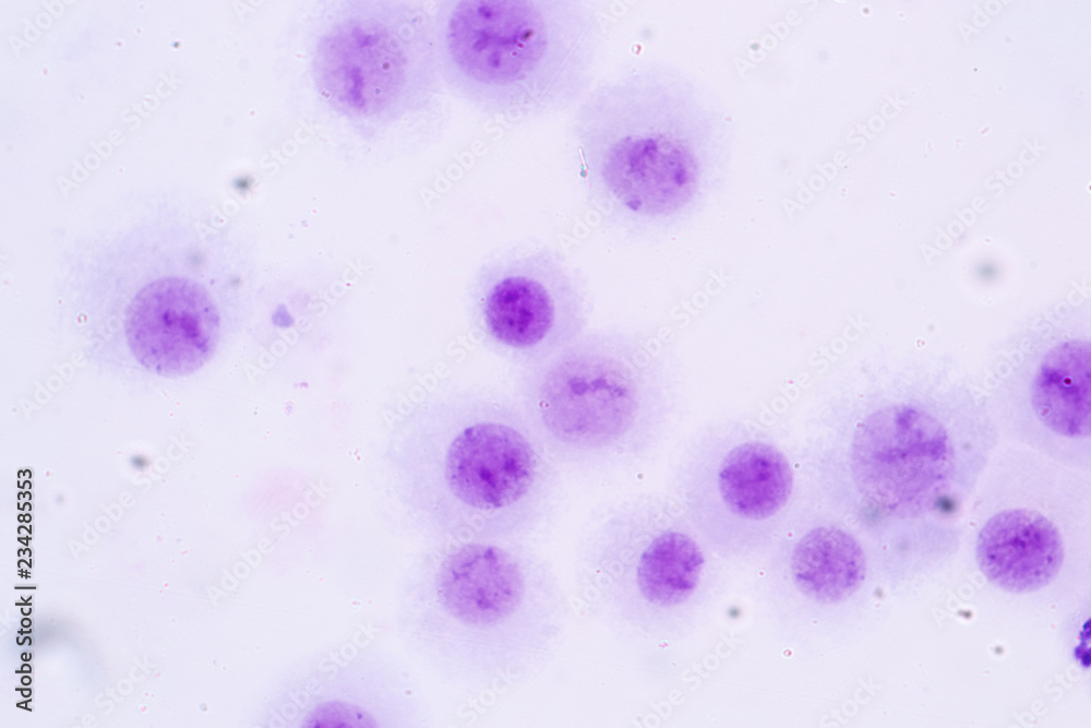 Chromosomes Human under the microscope for education in Lab. Chromosomes Human under the microscope for education in Lab.