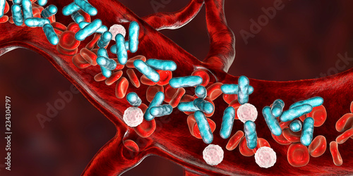 Sepsis, bacteria in blood photo