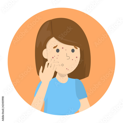 Sad woman with acne on the face