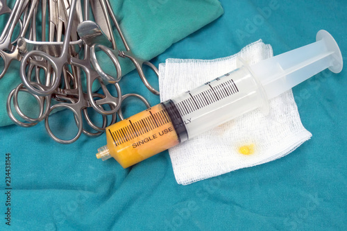 Close up fat syringes on the green surgical drapes for fat grafting or fat transfer procedure