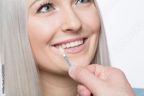 Am Mund einer h  bschen Frau wird ein Farbabgleich mit einer Zahnfarbprobe durchgef  hrt