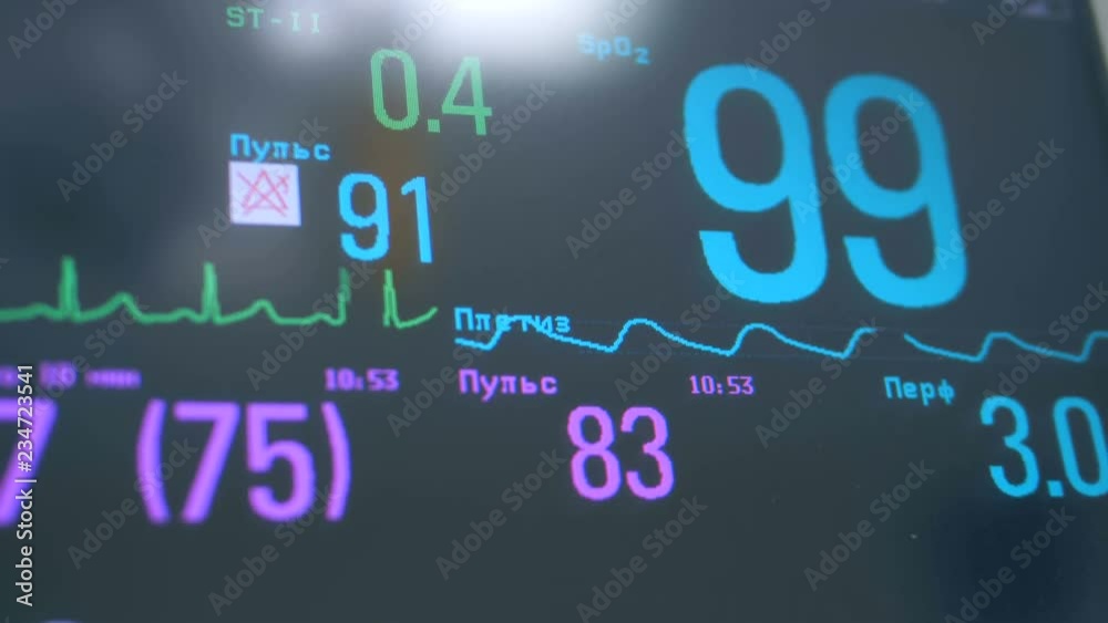 Close up of pulse and oxygen rate showings displayed on a medical screen Close up of pulse and oxygen rate showings displayed on a medical screen