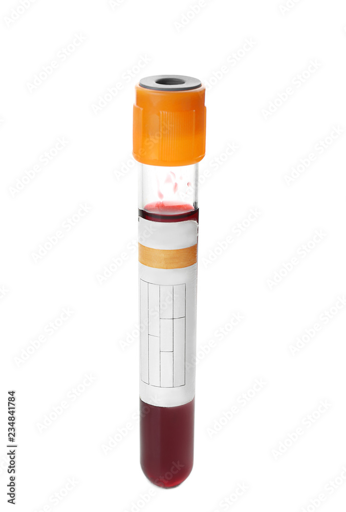 Test tube with blood sample on white background Test tube with blood sample on white background
