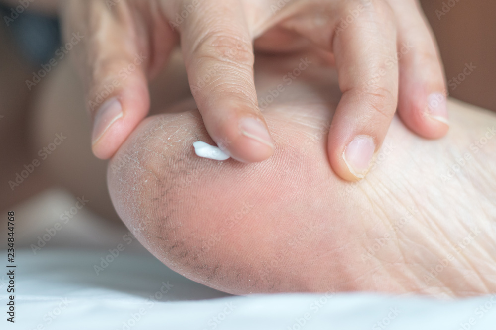 Vaseline Cracked Heels Overnight Treatment! 🤩No More Rough Feet!🤩Feet  Softening : u/JourneyToHealthCeels
