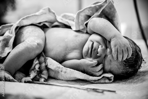 A newborn with a freshly cut umbilical cord lies on a table in the operating room.
