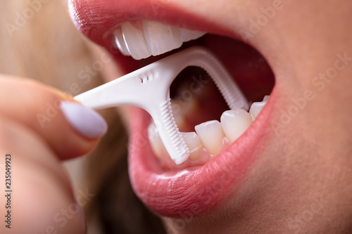 Obraz na plátně Woman Cleaning Teeth With Dental Floss