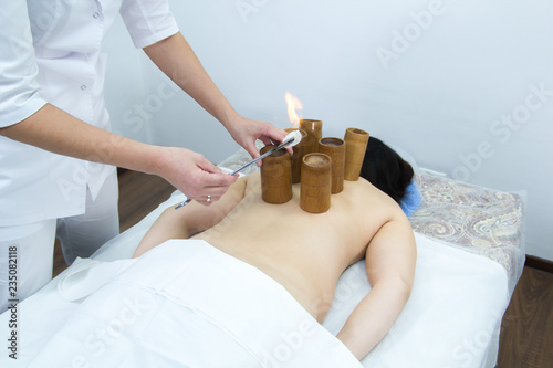 A woman taking a treatment of alternative medicine. Moxotherapy procedure. Burning up a cotton wool photo