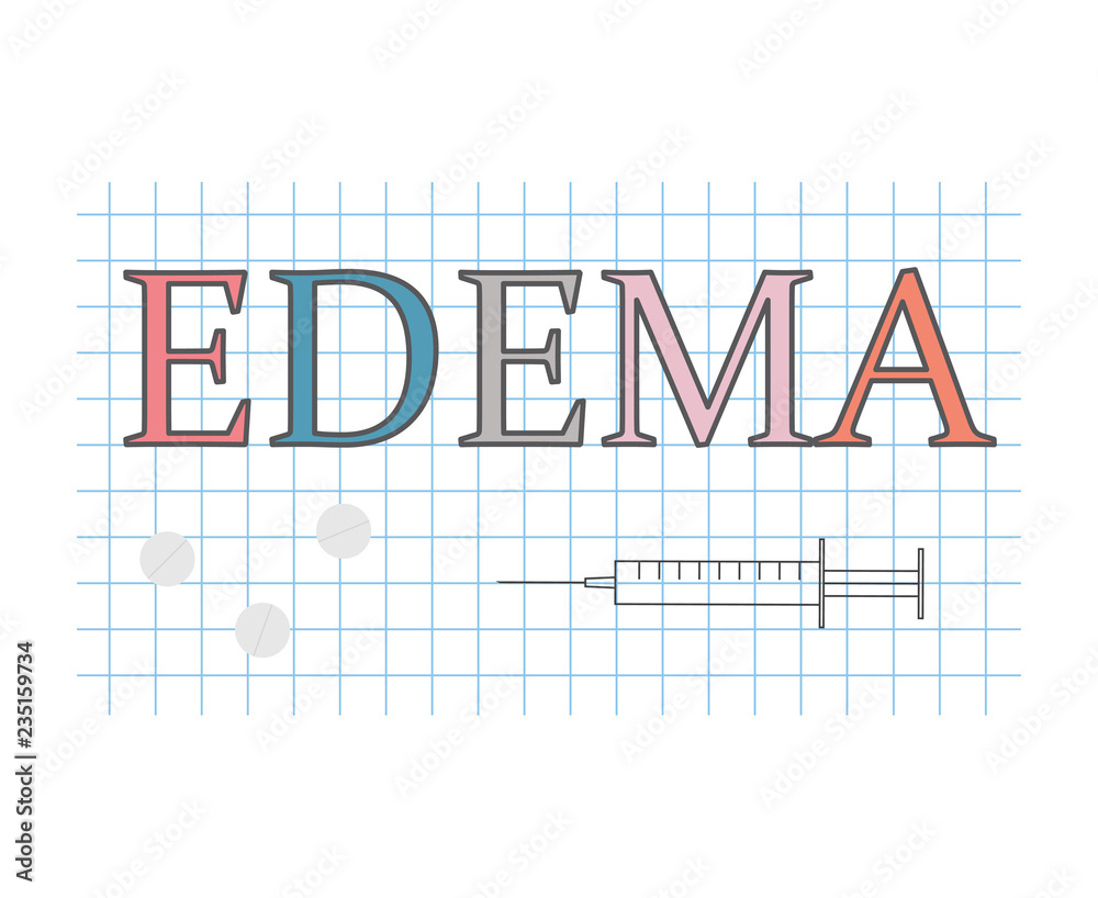 edema word on checkered paper sheet- vector illustration edema word on checkered paper sheet- vector illustration