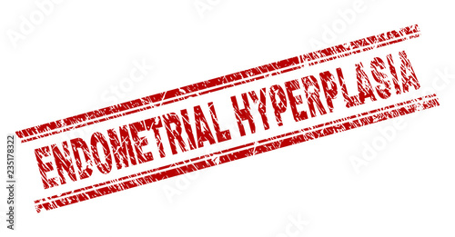 ENDOMETRIAL HYPERPLASIA seal print with grunge texture. Red vector rubber print of ENDOMETRIAL HYPERPLASIA tag with corroded texture. Text tag is placed between double parallel lines.