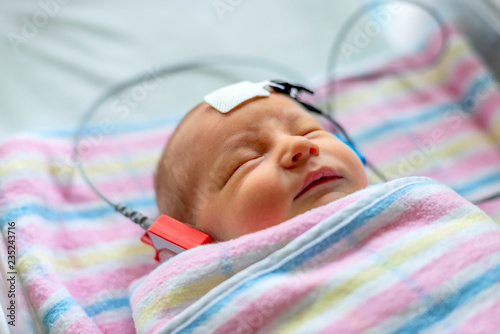hearing test of a sleeping newborn at hospital