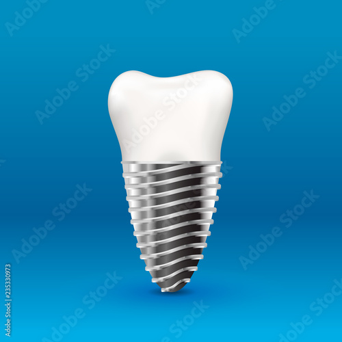 Glossy human tooth implant with metallic screw