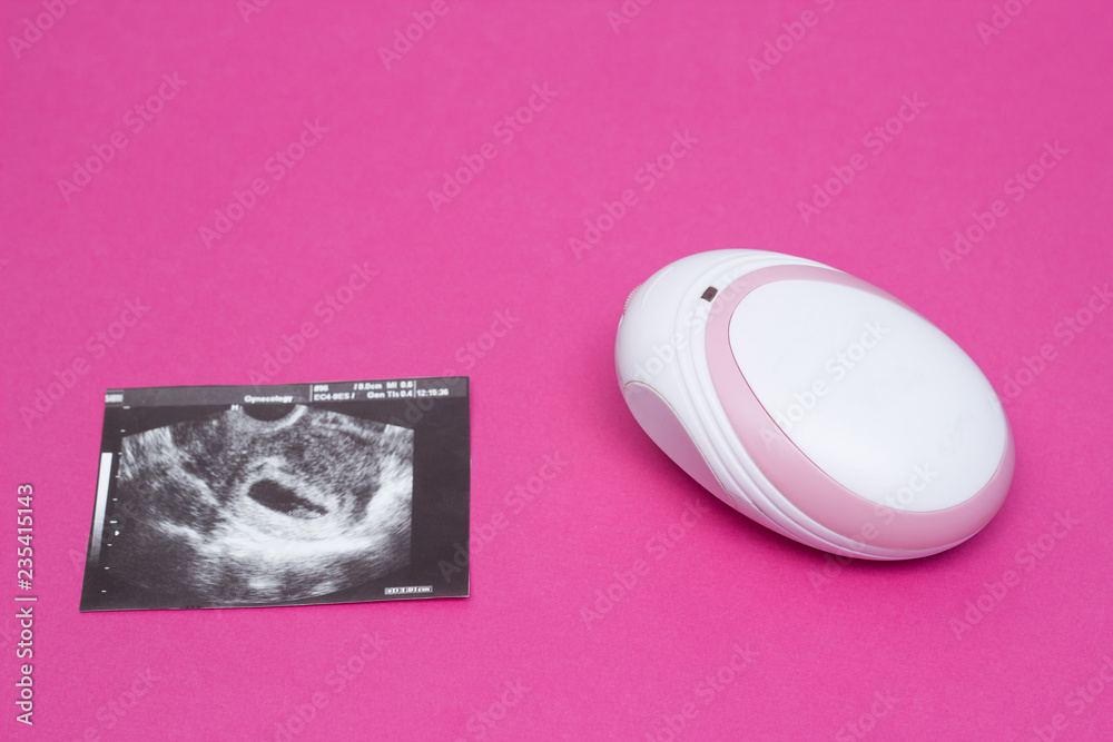 Fetal doppler for listening in a pregnant woman's heartbeat of a child and a picture of an