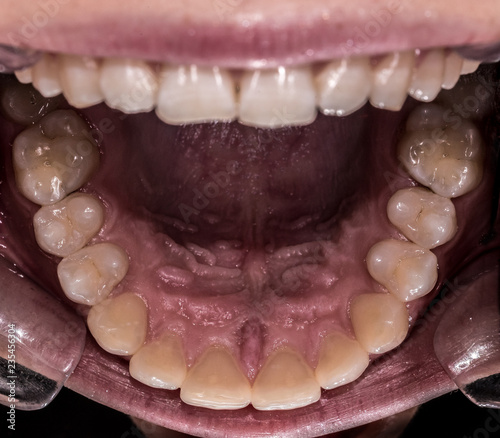Fotografie Healthy human maxillary teeth and palate, view from bottom