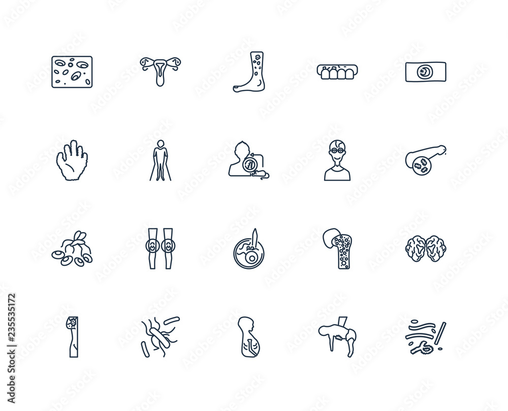 Lupus, Hyperopia, Jaundice, Leishmaniasis, Lymphoma, Lice, Parki Stock