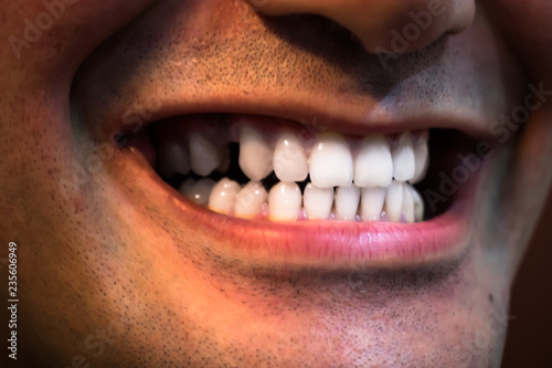 Fototapeta smiling toothless young man