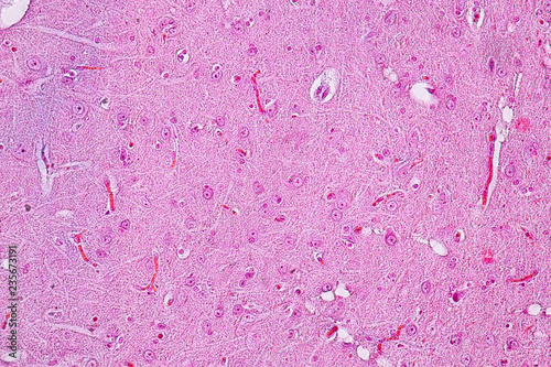 Cross section of the Cerebellum and Nerve human under the microscope for education in Lab. photo