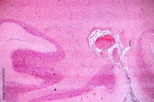 Cross section of the Cerebellum and Nerve human under the microscope for education in Lab. photo