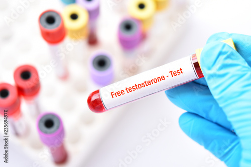 Blood sample tube for free testosterone hormone test
