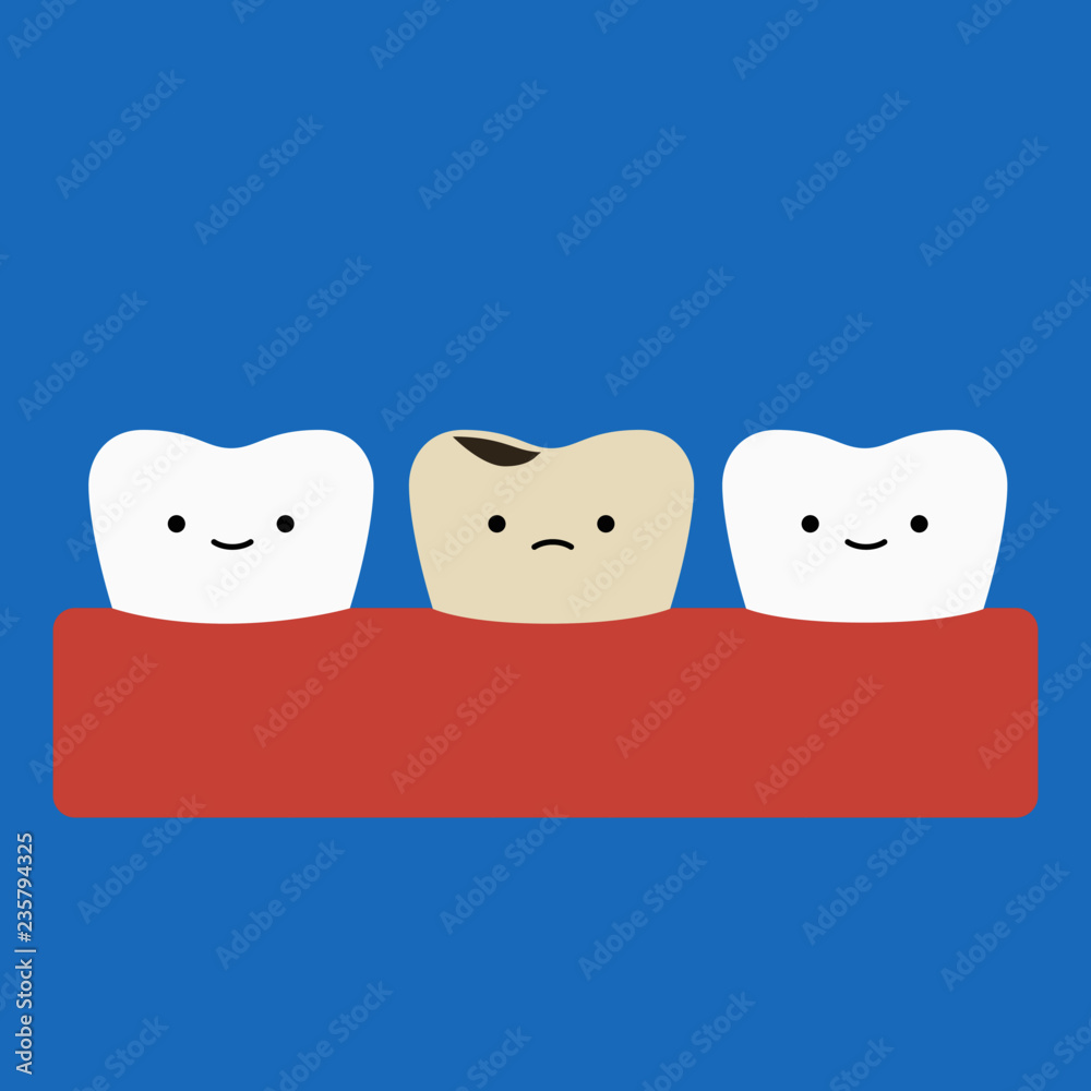 Obraz premium Diente con Caries Tooth Decay 