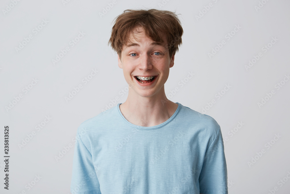 Incredibly, over-measure joyful guy smiles broadly, shows enthusiasm and passion, disheveled hair, mouth wide opened with braces on teeth, feels glad, over white background Incredibly, over-measure joyful guy smiles broadly, shows enthusiasm and passion, disheveled hair, mouth wide opened with braces on teeth, feels glad, over white background