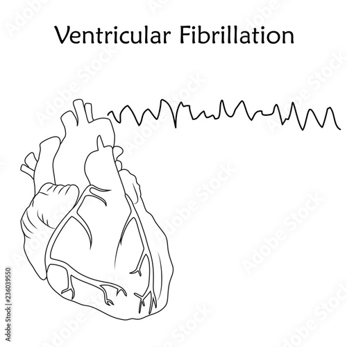 Human heart. Ventricular Fibrillation. Anatomy flat illustration. Outline image, white background. Heartbeat, pulse.