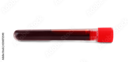 Test tube with blood sample on white background