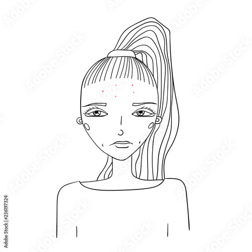 young girl with problem skin