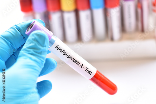 Blood sample tube for apolipoprotein A test 