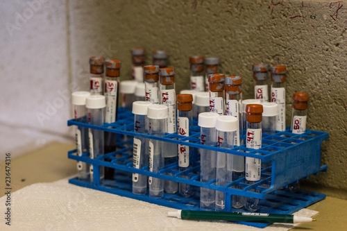 Vials of blood of horses who race on Kentucky Derby day