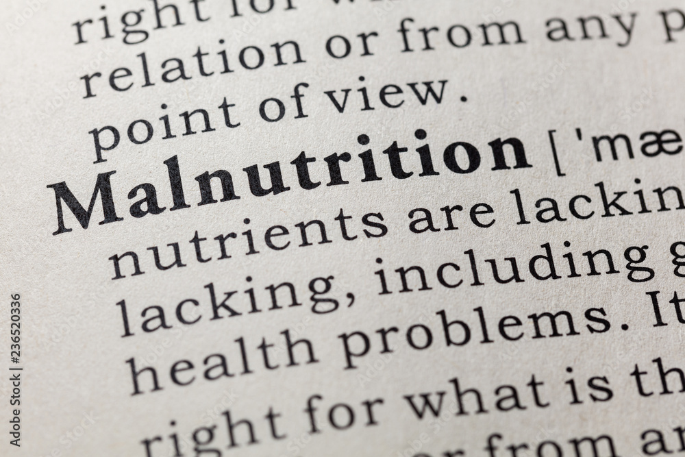 definition of malnutrition