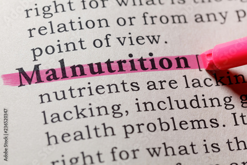 definition of malnutrition photo