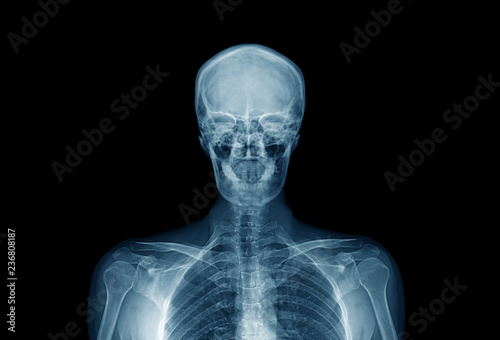 upper part of human body, hight quality x-ray image of human in blue tone
