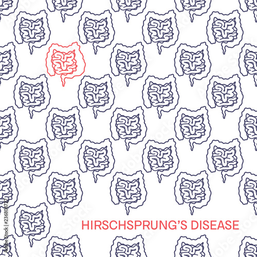 Hirschsprung's disease linear pattern medical poster photo