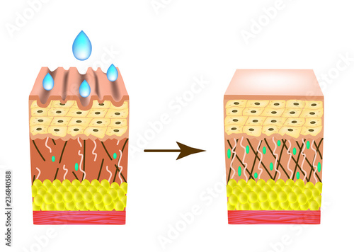 Wrinkles on the skin. Collagen deficiency. Impact on the skin with a drop of cosmetic. Infographics. Vector illustration on isolated background.